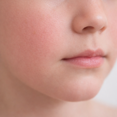 Kinderhaut Kinderhaut