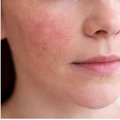 sensible Haut sensible Haut