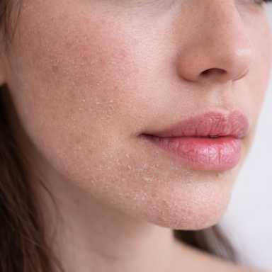 trockene Haut trockene Haut