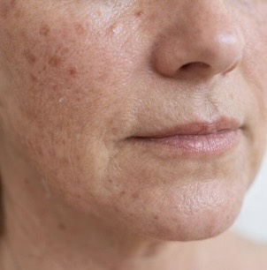 reife Haut reife Haut